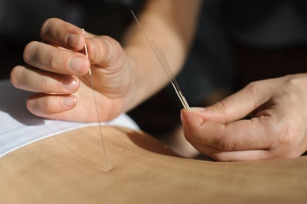 Balance Acupuncture - FAQs